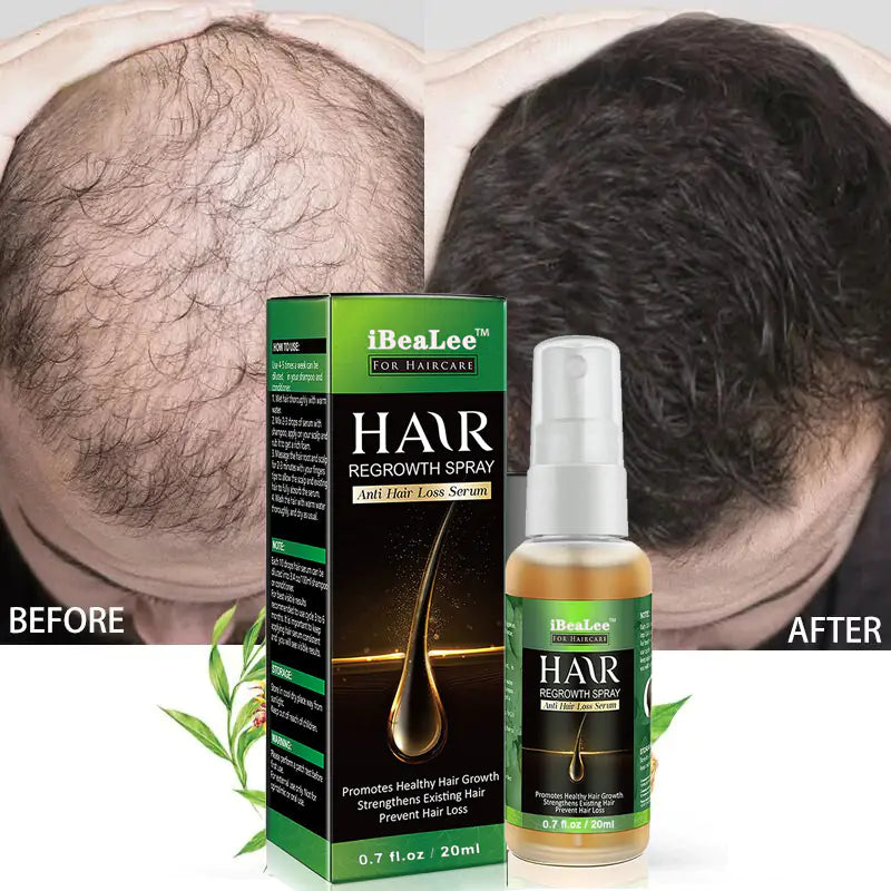 Hair Growth Spray